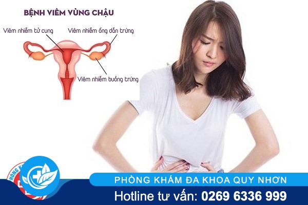 Triệu chứng viêm vùng chậu và cách điều trị