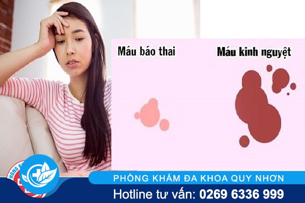Cách nhận biết máu báo thai chính xác