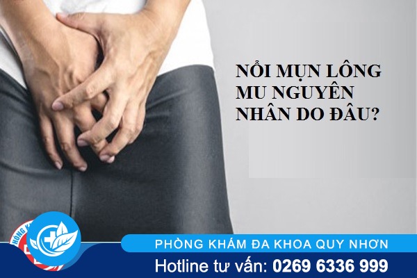 Nổi mụn lông mu là bị bệnh gì phải làm sao?