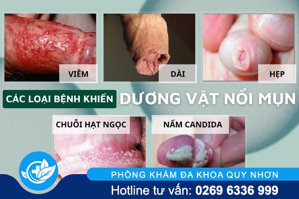 noi-mun-tren-duong-vat-la-bi-benh-gi-01