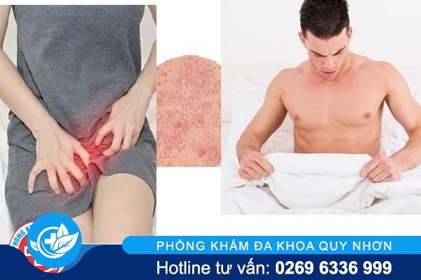 Vì sao bị nổi mụn vùng kín và cách chữa trị hiệu quả