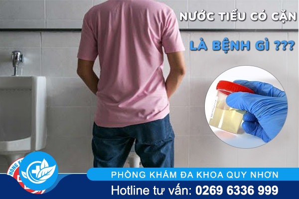 Nước tiểu có cặn nguyên nhân do đâu có phải bệnh lý?