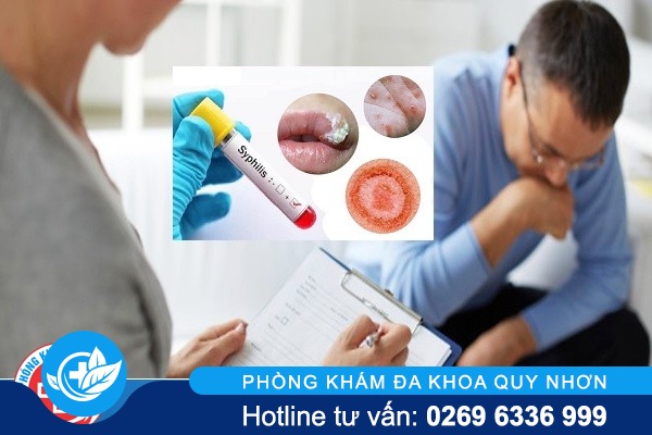 Chữa bệnh giang mai thế nào chi phí bao nhiêu?