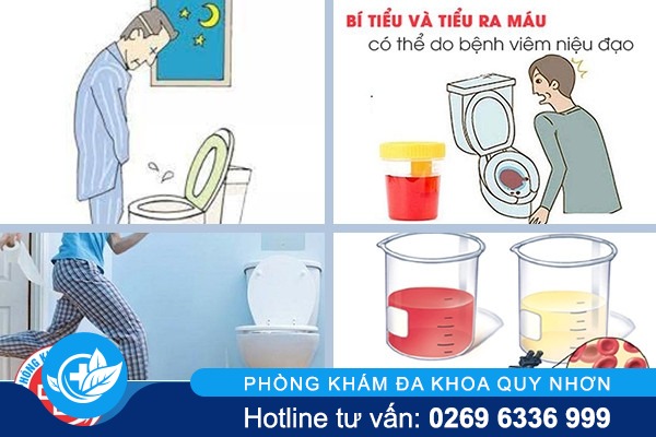 Rối loạn tiểu tiện dấu hiệu và cách điều trị