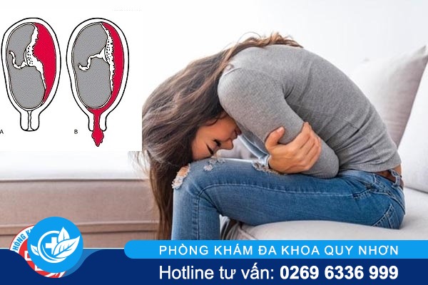 Dấu hiệu sót thai và cách điều trị