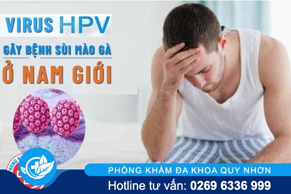 Nguyên nhân và cách điều trị sùi mào gà ở nam giới