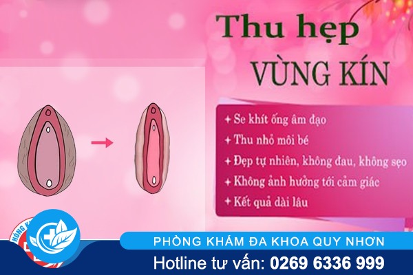 Có nên hơ than vùng kín sau sinh để làm đẹp?