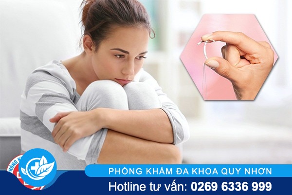 Tháo vòng tránh thai và những điều bạn cần biết
