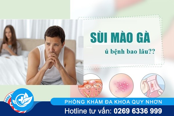 Thời gian ủ bệnh sùi mào gà bao lâu thì phát ra ngoài?