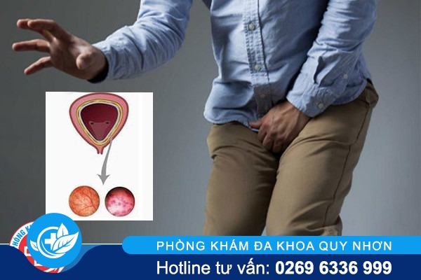 Tiểu khó là bị bệnh gì cách điều trị thế nào?