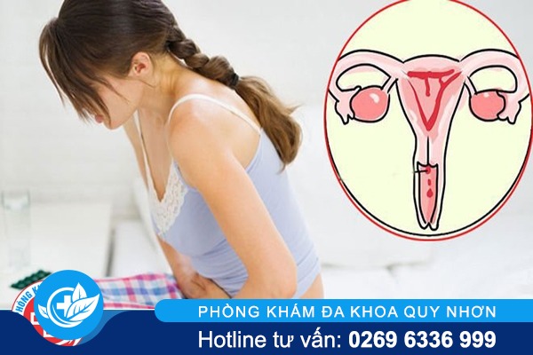 Dấu hiệu bệnh ung thư cổ tử cung và cách điều trị