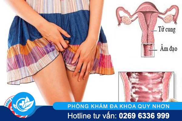 Ngứa âm hộ dấu hiệu cảnh báo bệnh phụ khoa nguy hiểm