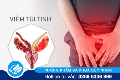 Viêm túi tinh nguyên nhân dấu hiệu và cách điều trị