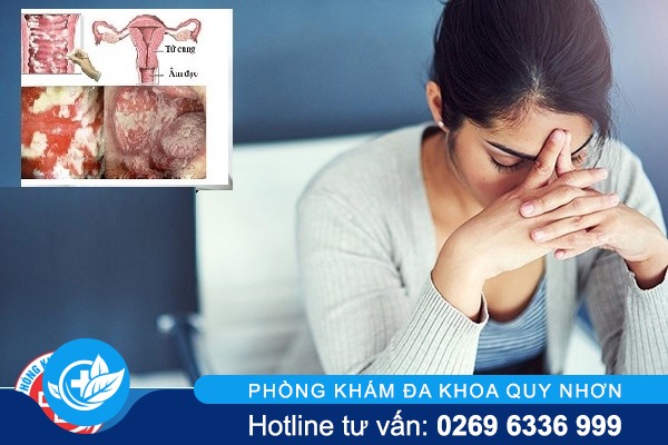 Vùng kín nổi đốm trắng có phải bệnh phụ khoa?