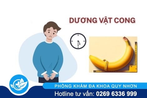Cong dương vật ở nam giới nguyên nhân và cách điều trị