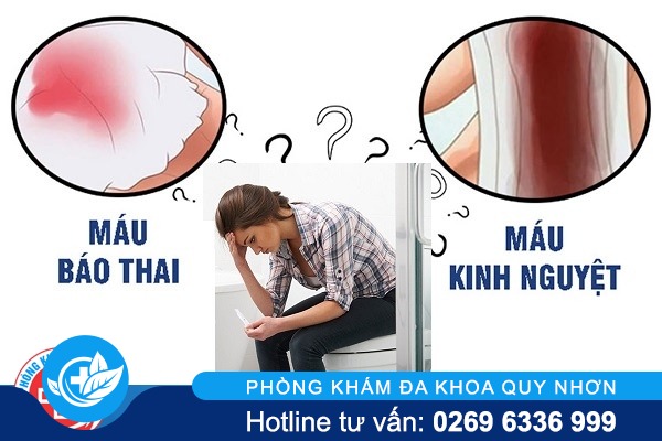 Cách phân biệt máu báo thai và máu kinh