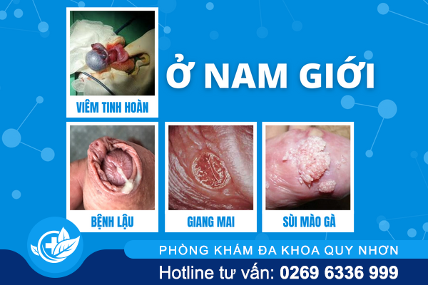 giai-dap-hien-tuong-noi-hach-o-hang-1