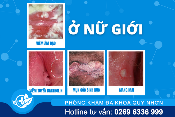 giai-dap-hien-tuong-noi-hach-o-hang-2