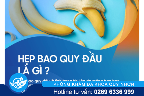 Cắt hẹp bao quy đầu thế nào chi phí bao nhiêu?