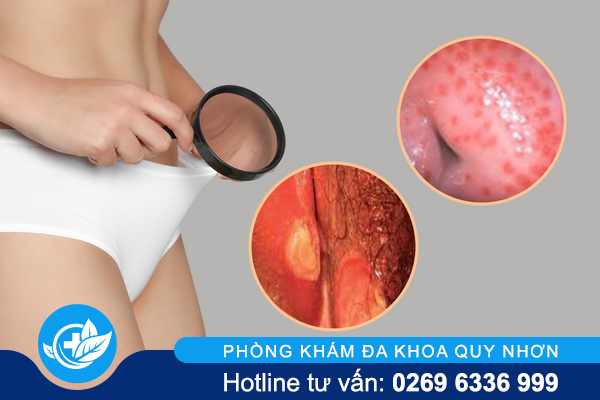 noi-man-do-ngua-o-vung-kin-la-bi-benh-gi-0