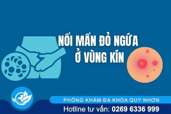 Nổi mẩn đỏ ngứa ở vùng kín là bị bệnh gì?