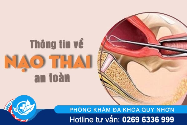 Thông tin về biện pháp nạo thai an toàn