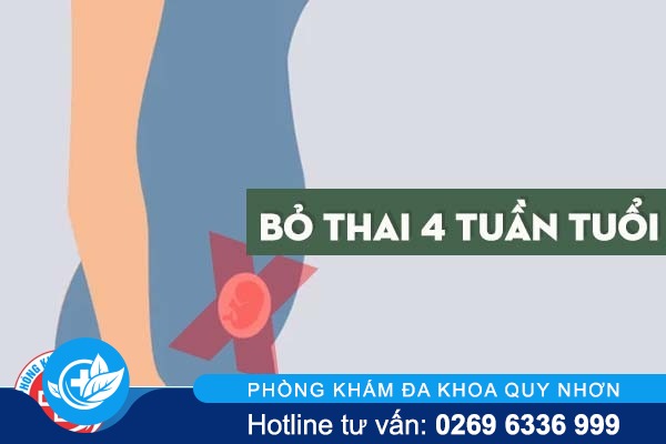 Thực hiện bỏ thai 4 tuần tuổi được không?