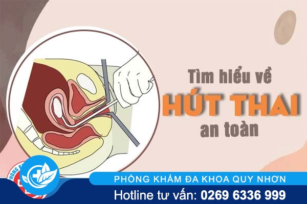 Tìm hiểu về biện pháp hút thai an toàn