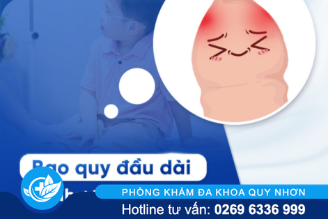 Đâu là biện pháp cắt dài bao quy đầu hiệu quả? 