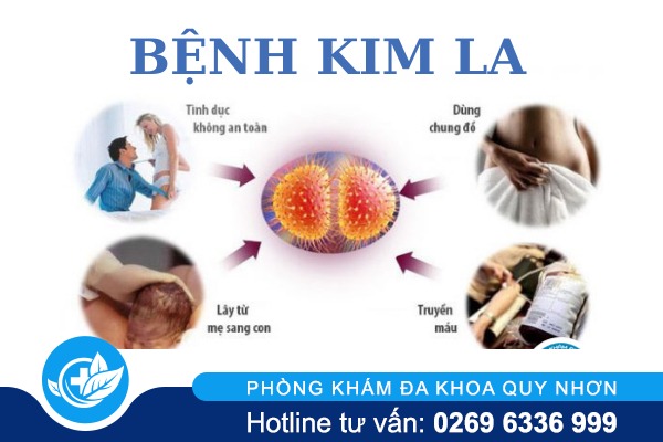 Bệnh kim la là gì nguy hiểm không?