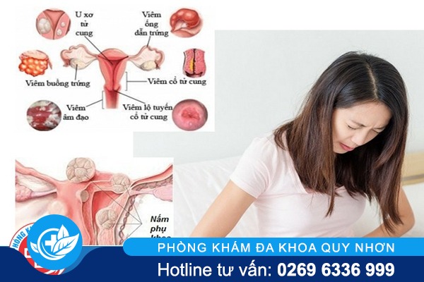 Các bệnh phụ khoa thường gặp hiện nay