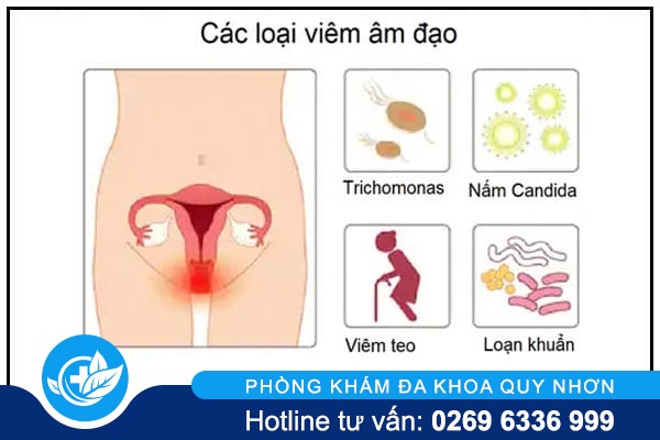 benh-vung-kin-la-gi-va-bieu-hien-ra-sao-2