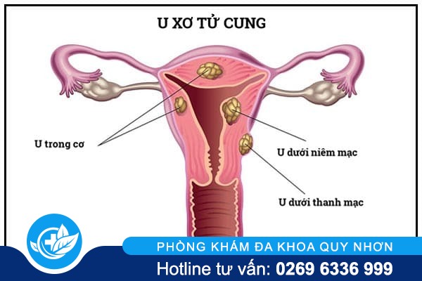 benh-vung-kin-la-gi-va-bieu-hien-ra-sao-3