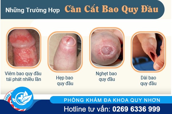 cat-bao-quy-dau-khi-nao