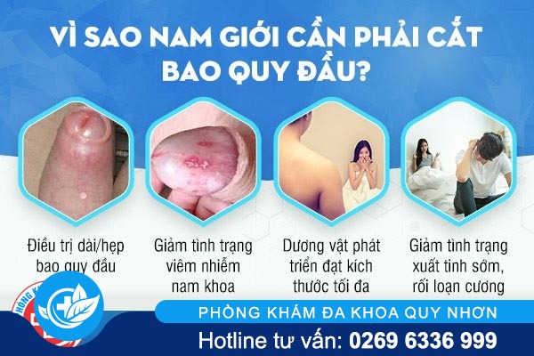 cat-bao-quy-dau-vi-sao-nam-gioi-can-thuc-hien-som-1