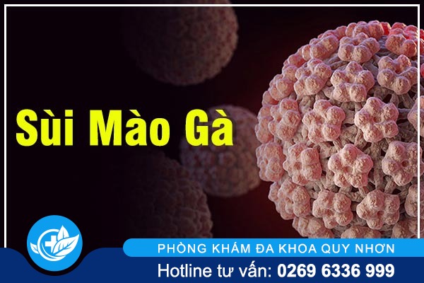 Điểm danh các tác hại sùi mào gà