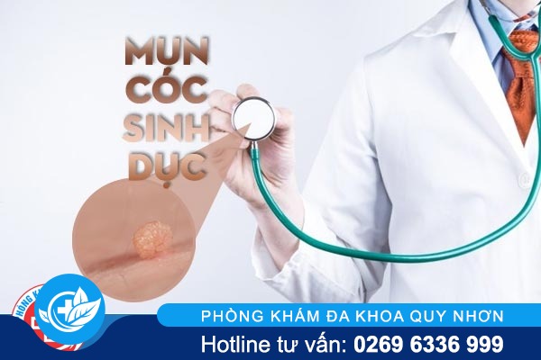 Điều cần biết về mụn cóc sinh dục