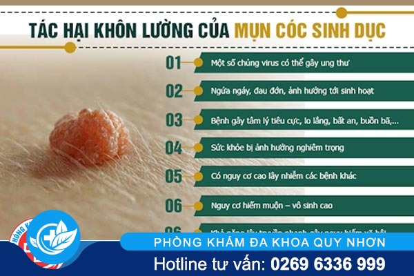 dieu-can-biet-ve-mun-coc-sinh-duc-3