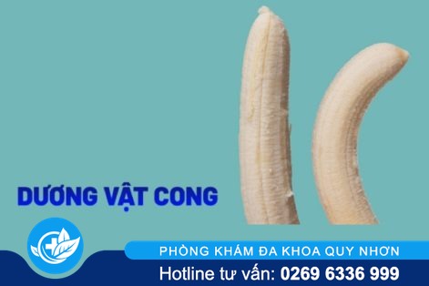 Dương vật cong phải làm sao?