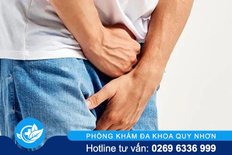 Dương vật nổi hạch – nguyên nhân và cách điều trị hiệu quả