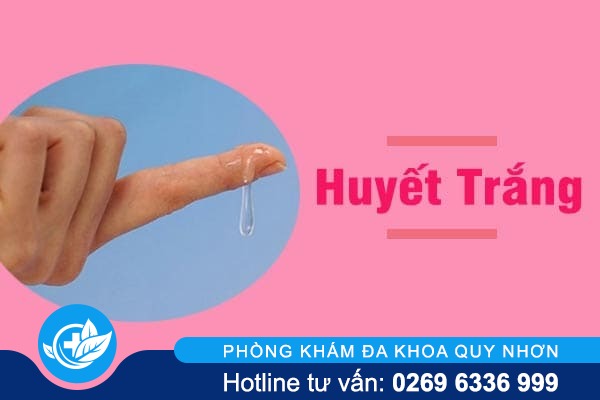 Huyết trắng – Những lưu ý không nên bỏ qua