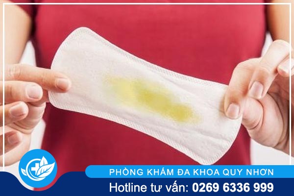 khi-hu-bat-thuong-canh-bao-benh-phu-khoa-nguy-hiem-1