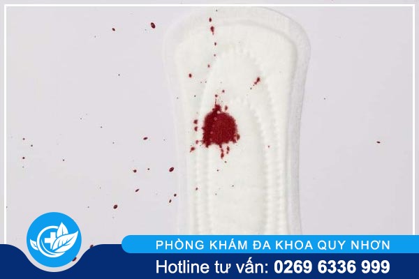 khi-hu-bat-thuong-canh-bao-benh-phu-khoa-nguy-hiem-2