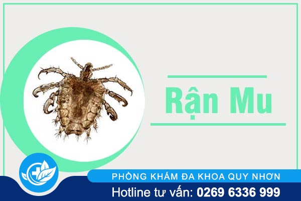 Những sự thật cần biết về rận mu