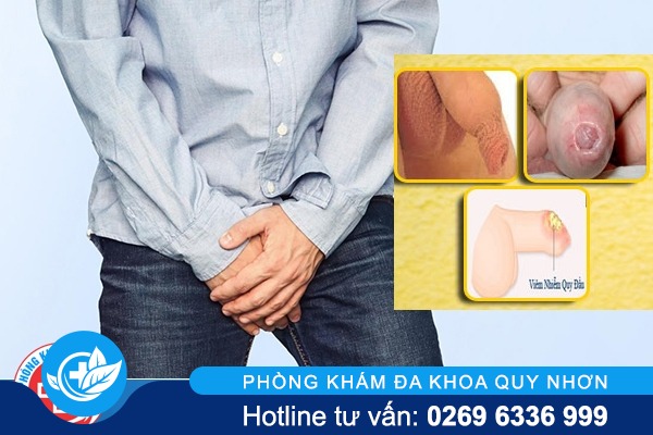 phong-kham-bao-quy-dau