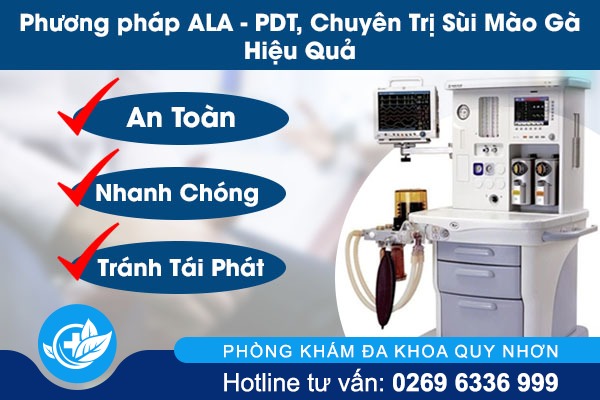 Sùi mào gà và những điều cần biết
