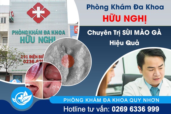 Phòng Khám Đa Khoa Quy Nhơn - Địa chỉ chữa sùi mào gà hiệu quả, hợp lý