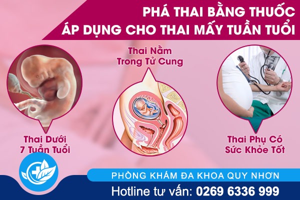 Tổng quan thông tin phá thai bằng thuốc