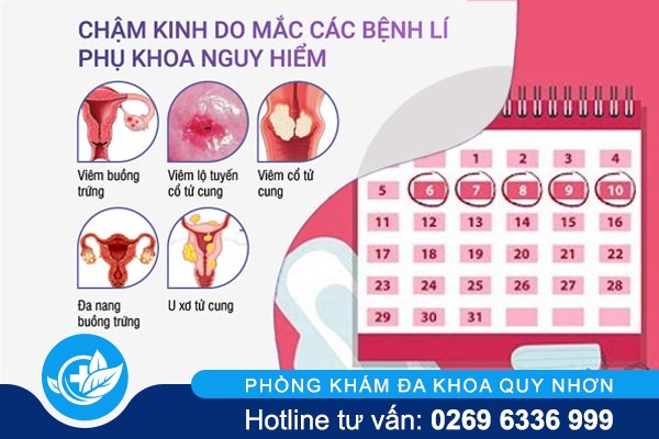 tong-quan-ve-cham-kinh-nguyet-o-nu-gioi-3