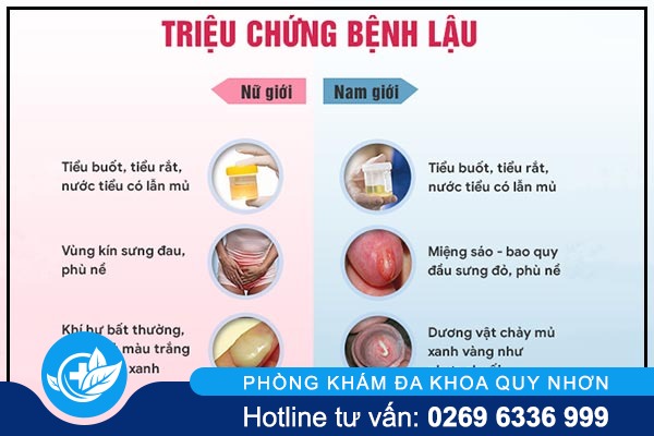 benh-lau-toc-do-lay-nhiem-nhanh-va-de-khang-thuoc-3